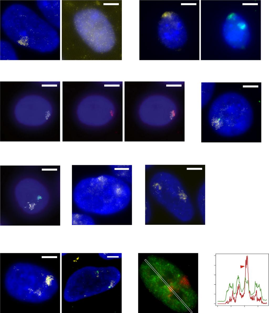 A C E H F B I G D Figure 4. Single-Cell Monitoring of X Chromosome Activity in hescs (A) X-paint RNA-FISH (yellow) in XaXi H9 cells with or without initial RNase treatment.