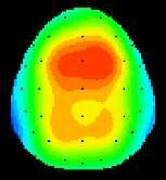 Frontal midline theta & cognition in healthy older adults Only frontal (not posterior) theta power correlated significantly with cognitive