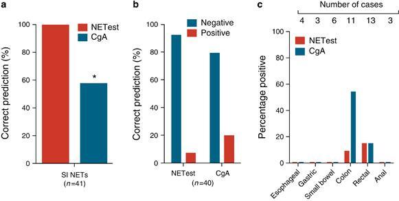 MAAA PCR-BASED TEST (NETEST) Multianalyte with Algorithm Analysis Assay Using gene microarray-based approaches of both malignant