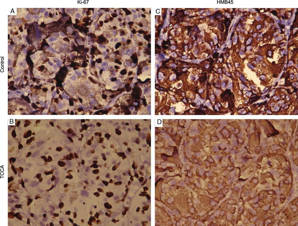 Shen and Wu Appl Immunohistochem Mol Morphol Volume 23, Number 4, April 2015 Melanin Bleaching DAB Bleaching Our results showed that after potassium permanganate (Fig. 1B), potassium dichromate (Fig.