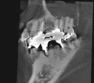 The fine detail of the bone, especially in the coronal view, allows the clinician and the patient