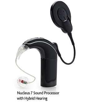 Hybrid Cochlear Implants The implant or the sound