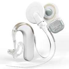 Advanced Bionics Naida Q90 EAS Residual hearing can