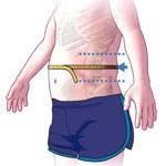 Obesity Measures 1) Skinfold measurements