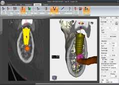 A useful communication & motivation tool All the images generated by NewTom Implant Planning can be used to communicate with the patient, in compliance with the
