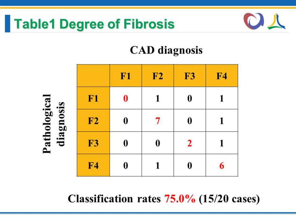 Results The correct classification rate of fibrosis for all cases was 15/20 (75.0%). Number of correct classification cases for each category was 0/2 (F1), 7/8 (F2), 2/3 (F3), and 6/7 (F4) (Table1).