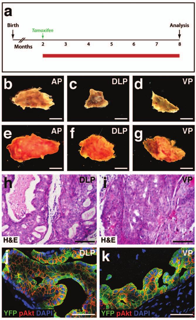 Figure S5 Phenotypes of PIN/tumor lesions following Pten deletion in basal cells.