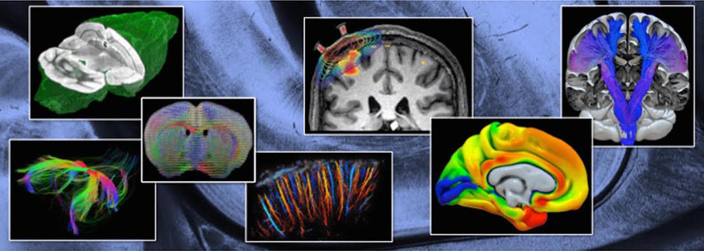 Whole Brain Imaging 8-28 September 2019 Course director: Katrin Amunts (Jülich Research Centre, Germany) Co-directors: Bernard Mazoyer (University of Bordeaux, France) Sylvain Miraux (University of
