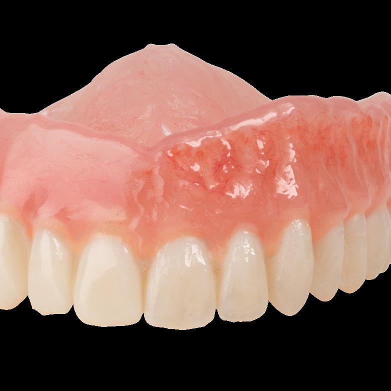 denture, you can use Pala cre-active to