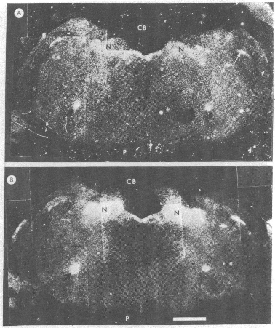 6242 Neurobiology: Goodman et al. Proc. Natl. Acad. Sci. USA 77 (1980) FIG. 4. Dark-field micrographs of coronal sections of rat medulla oblongata, showing delta and mu opiate receptor distribution.