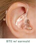 or sudden deafness Rapid loss of hearing Ménière s disease Causes dizziness,