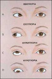 10 Eye Reflexes Internal muscles controlled by autonomic nervous