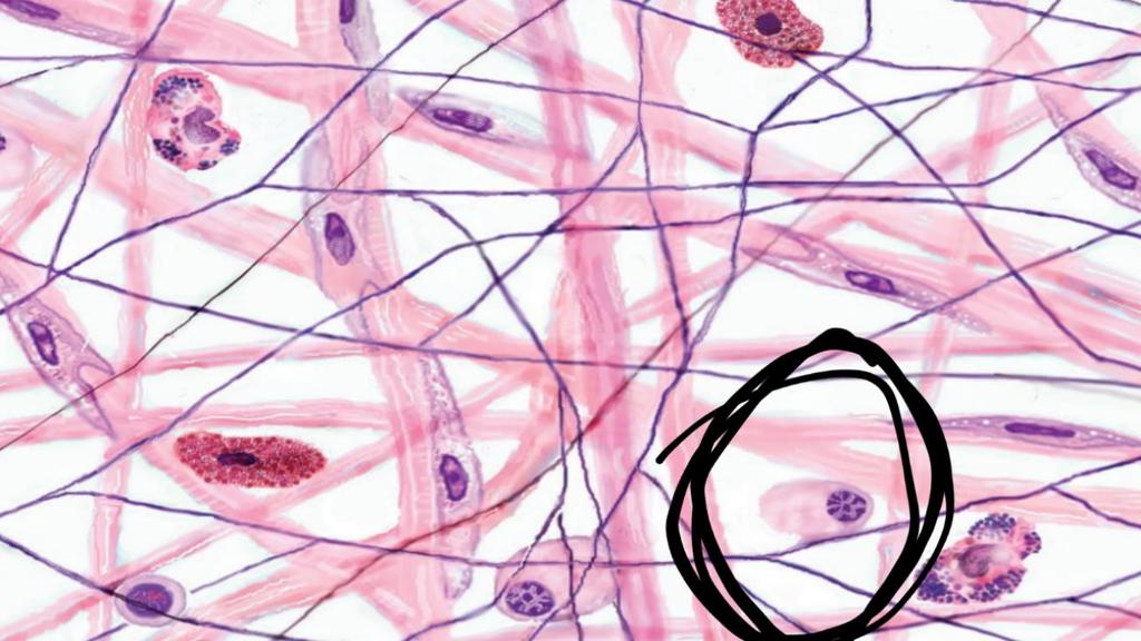2) Identify the circled cell: