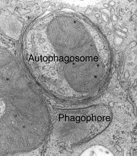 cells Programmed cell death-autophagy results in total destruction of the cell Antigen