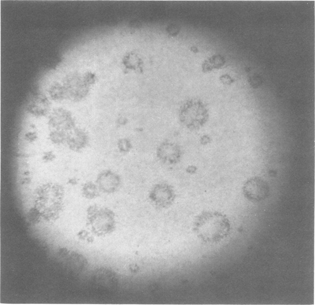 64 SCHMIDT, DENNIS, AND LENNETTE J. CLIN. MICROBIOL. FIG. 2. Foci of CMV-infected cells stained with neutral red 12 days after infection. x5. TABLE 1.