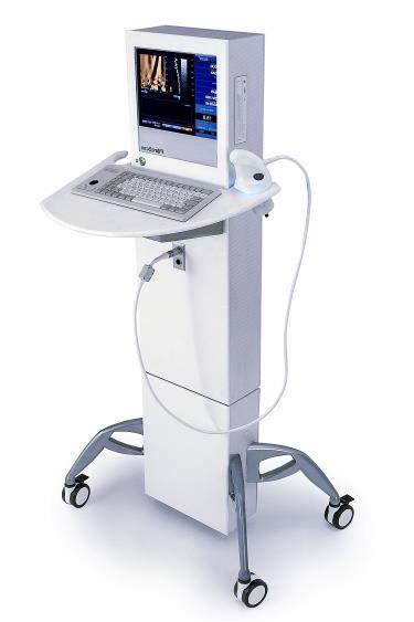 Fibrosis Assessment with Fibroscan Measurements are performed on the right lobe of the