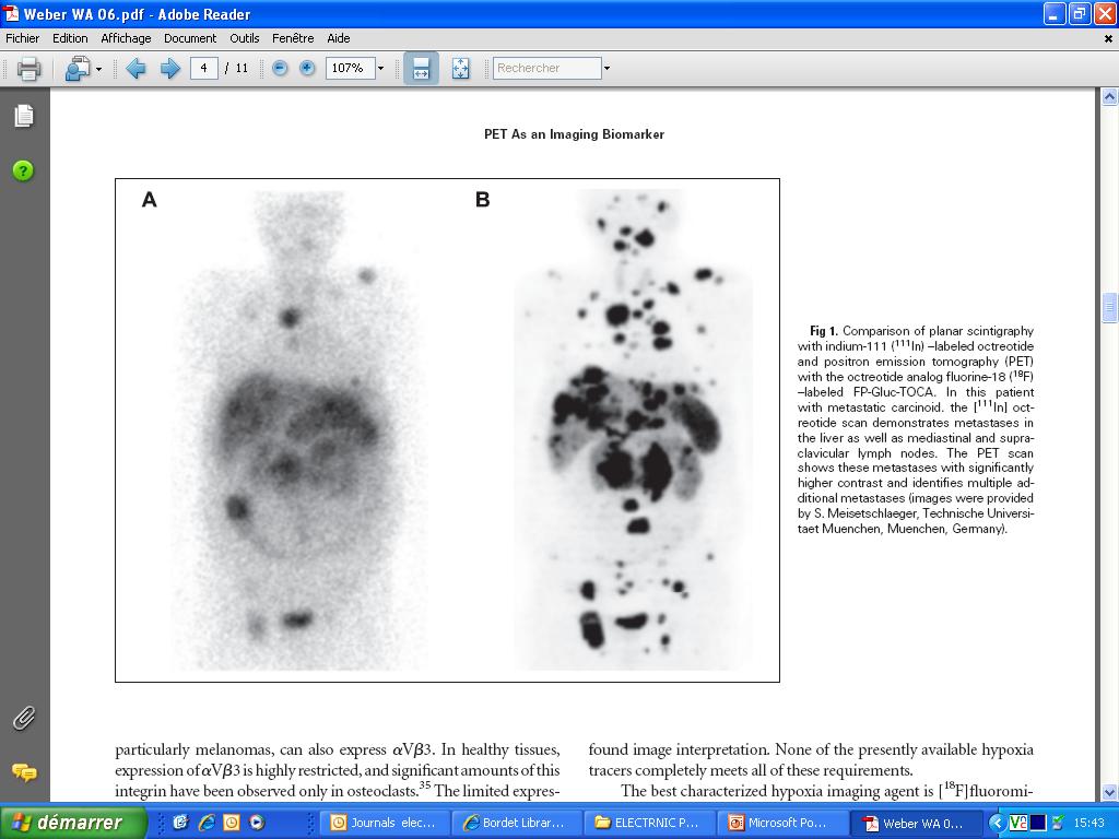111 In-octreotide SPECT/CT vs 68