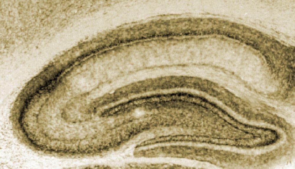 Major pathways in hippocampal slices CA1 CA2 Schaffer collateral commisural Subiculum