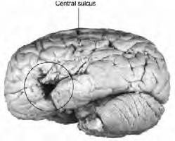 Frontal Lobe Broca s Aphasia Parietal Lobe Broca s Aphasia Patients have trouble producing speech, mostly content words (nouns and verbs) with few grammatical morphemes Yes ah