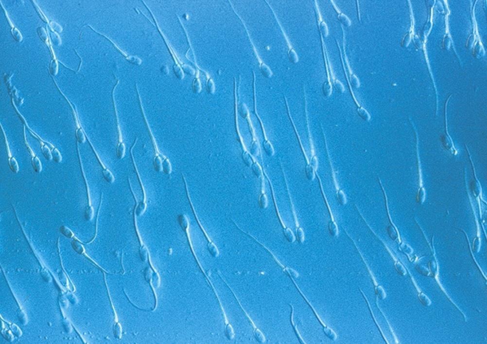 Cilia & Flagella Provide motility Cilia Short Used to move substances outside human