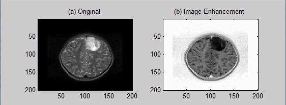 I ( x, y ) : intensity of the image at the point (, ) x y. α : width of the gradient magnitude around brain image. β : gradient magnitude around brain image.