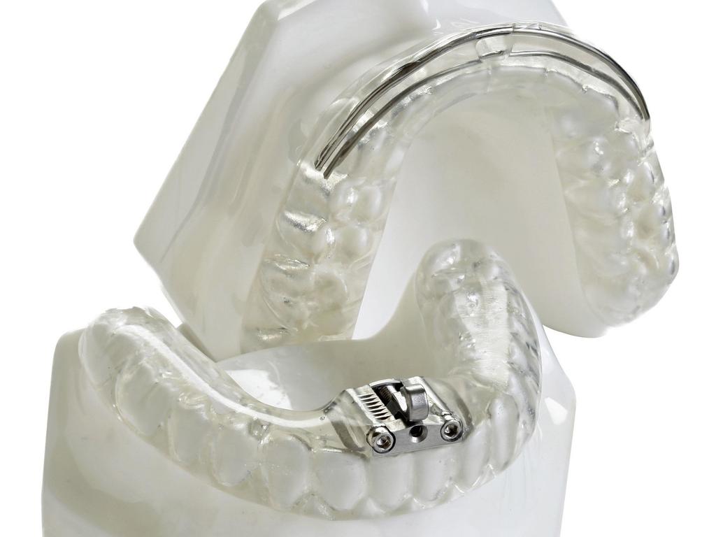 Step 6 The Dental Solution For a long term treatment, an oral appliance is the best solution. Easy to use with few side effects.