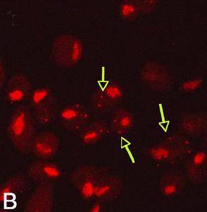 Mycoplasma s Can hide inside Trichomonads to avoid antibiotics Dessi et al 2006.