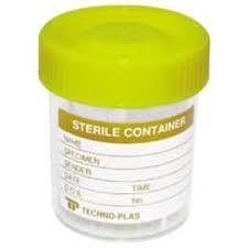 Urine Specimen Storage Urine must be collected into clean (preferably sterile) container (usually yellow-top urine containers) Ideally urine should be analysed immediately after collection ph