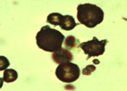 Some with uroliths do not have crystalluria Crystalluria Struvite Calcium oxalate (dihydrate)