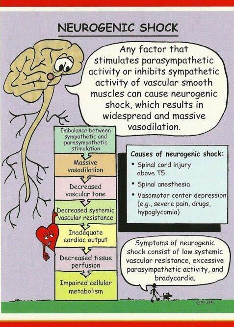 Neurogenic shock Results from the interruption of sympathetic tone due to disruption in supraspinal control,