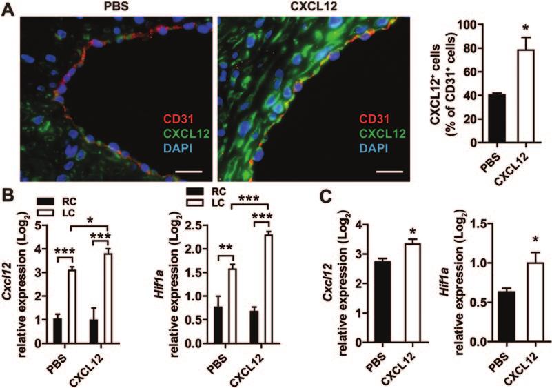 Akhtar et al CXCL12 and Plaque Stabilization 683 Figure 4. Systemic CXCL12 treatment induces lesional CXCL12 expression.