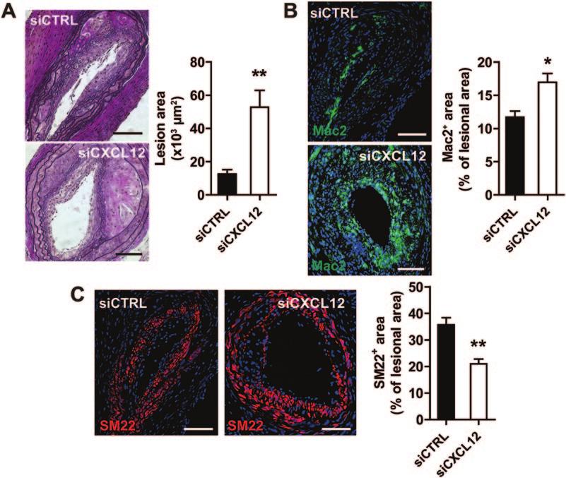 B, Expression levels of Cxcl12 and Hif1a mrna were determined in partially ligated left (LC) and untreated right (RC) carotid arteries of Apoe / mice treated with PBS or CXCL12 for 4 weeks.
