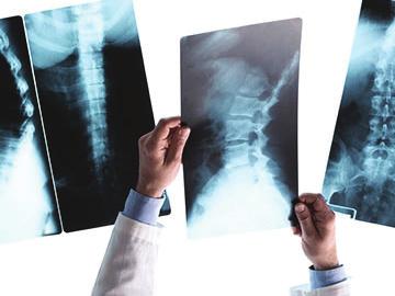 Spondylolisthesis Prior to having a surgical procedure to treat your spondylolisthesis, conservative measures such as physical therapy, chiropractic, and steroid injections should be attempted.