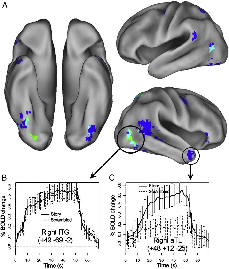 T. Yarkoni et al. / NeuroImage 41 (2008) 1408 1425 1417 cognitive cost i.e., by actively maintaining more story-relevant information online as a narrative grows more elaborate activation in comprehension-related regions should increase over time.