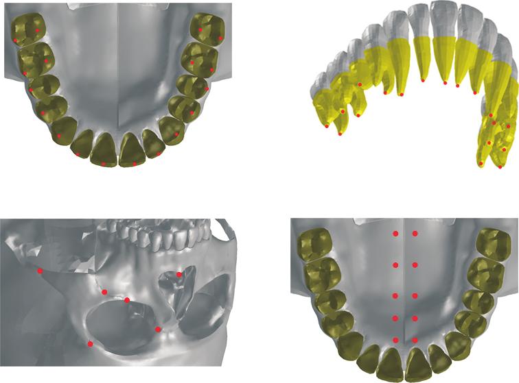 A C B D Figure 1. Illustrations of the skeletal and dental landmarks. A, Skeletal landmarks; B, Land marks at the midpalatal suture; C, Occlusal dental landmarks; and D, Radicular dental land marks.
