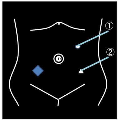 The double circles and the triangle on the left side of the image are reused ports.
