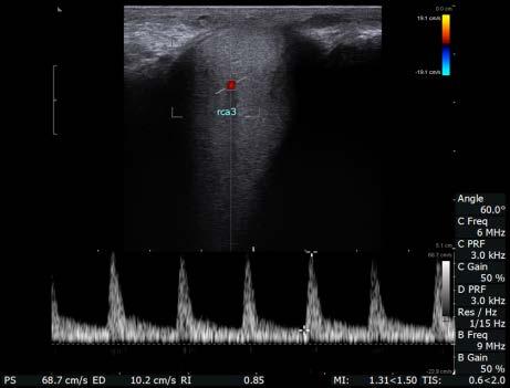 Patient Examples 60 yo PD male 40 dorsal