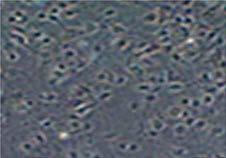 pre-adipocyte cells,