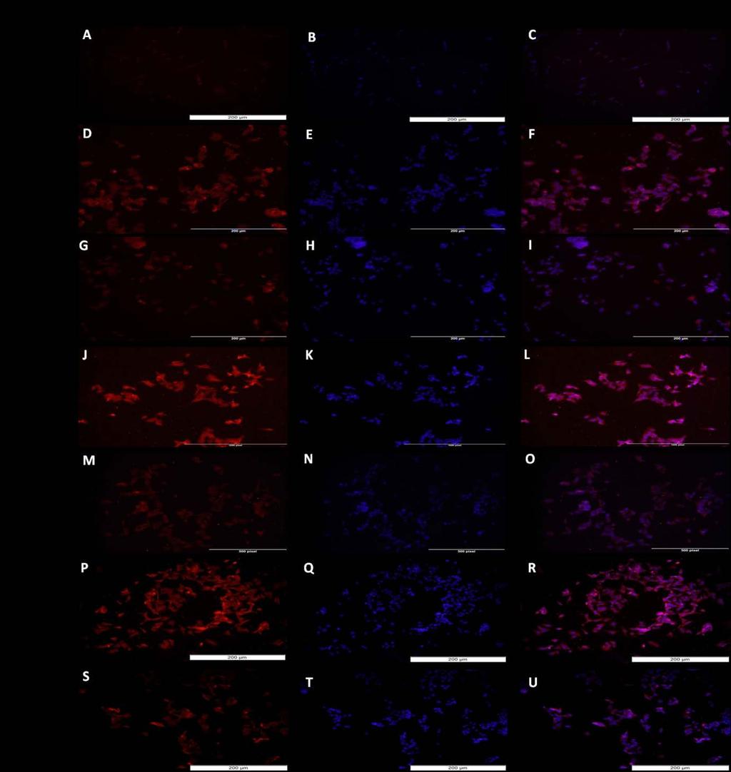 Figure 13: Immunofluorescence staining for effect of vitamin D on TREM-1 expression in HepG-2 cells.