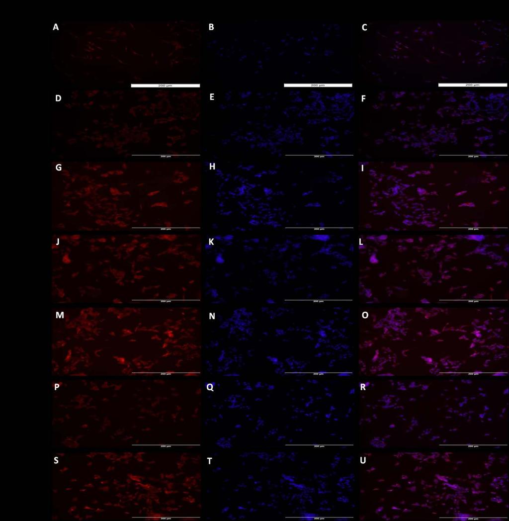 Figure 14: Immunofluorescence staining for effect of vitamin D on TREM-2 expression in HepG-2 cells.