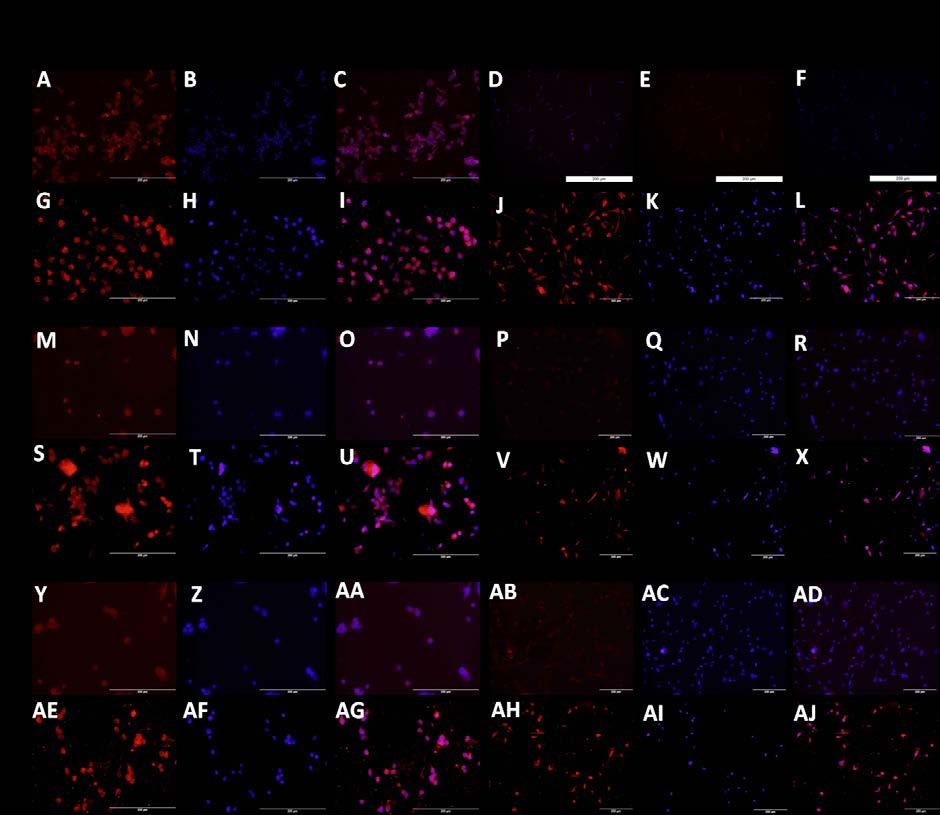 Figure 19: Immunofluorescence staining for the effect of rhmgb-1 on TREM-1, IL-6 and TNF-α expression in HepG-2 and THLE-2 cells.