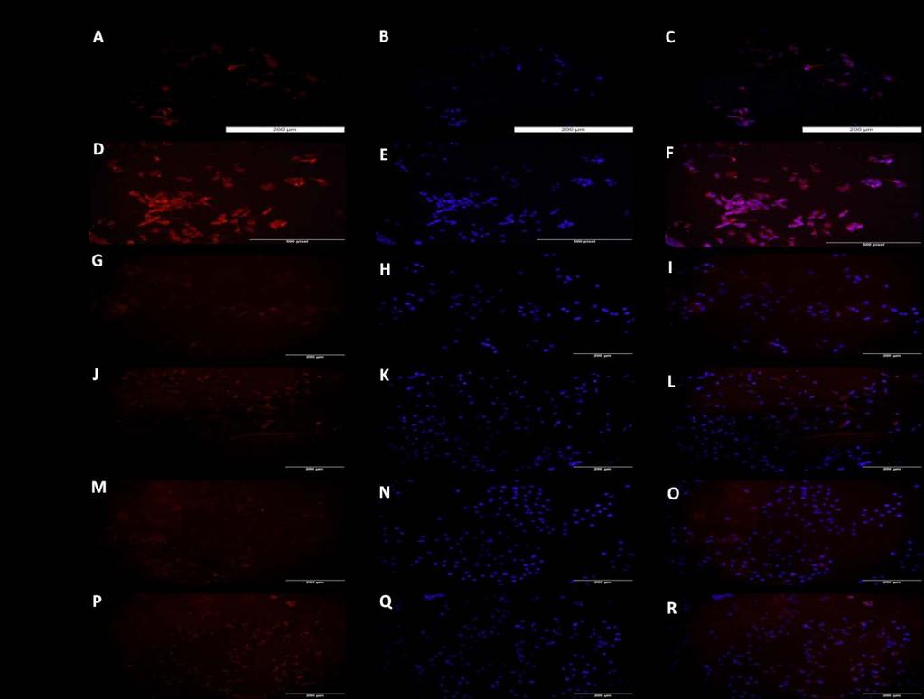 Figure 21: Immunofluorescence for TREM-1 expression in HepG-2 cells after signalling pathway inhibitor treatment.