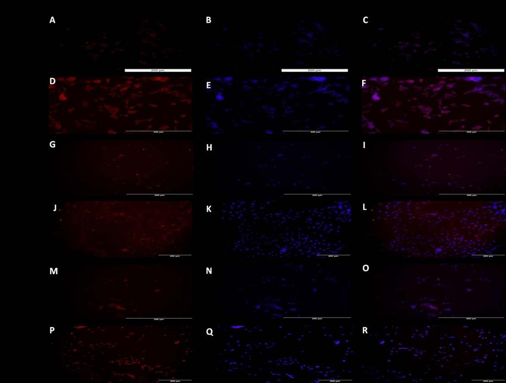 Figure 22: Immunofluorescence for TREM-2 expression in HepG-2 cells after signalling pathway inhibitor treatment.
