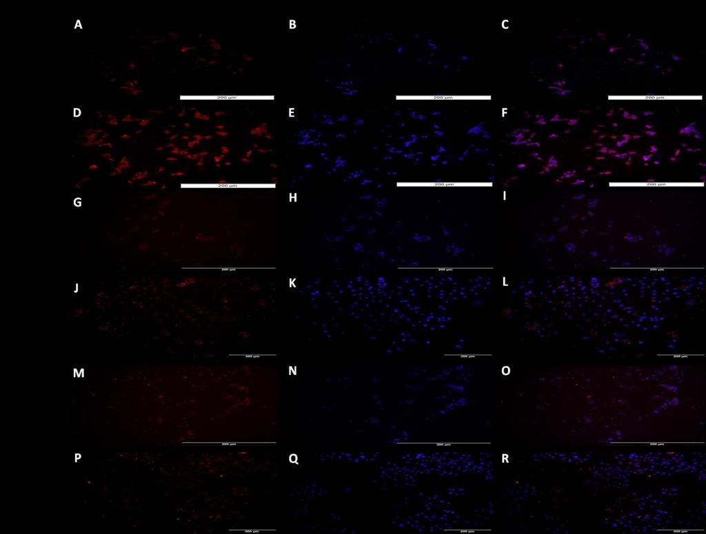 Figure 24: Immunofluorescence for TREM-2 expression after signalling pathway inhibitor treatment.
