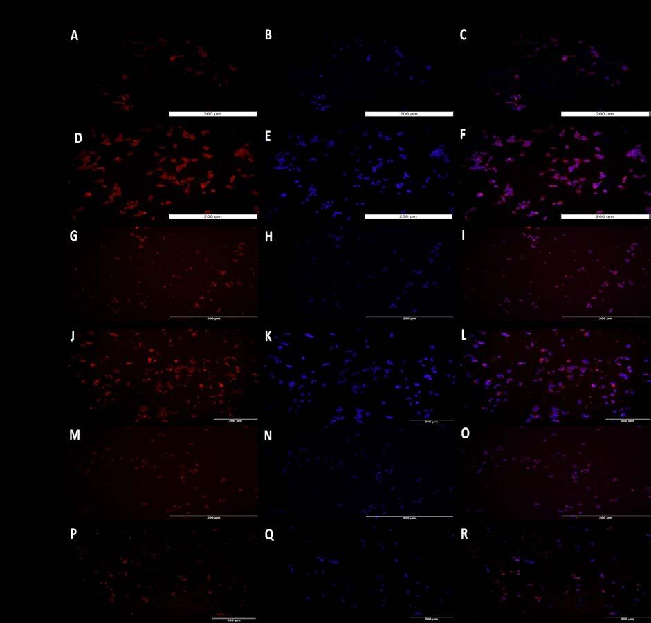 Figure 31: Immunofluorescence for TREM-2 expression after signalling pathway inhibitor treatment.