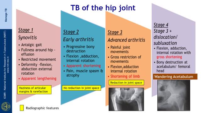 (Refer Slide Time: 02:50) So, TB of the hip joint, there are various stages.