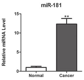 TONG et al: microrna-181 PROMOTES PROSTATE CANCER CELL PROLIFERATION 1297 of the interest genes, qpcr was performed using a SYBR Green Premix Ex Taq (Takara, Dalian, China).