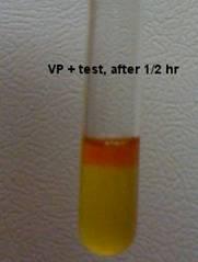 cap) for at least 30 minutes (45 minutes is even better) as the light pink color intensifies at the top of the tube (the reagents react with acetoin).