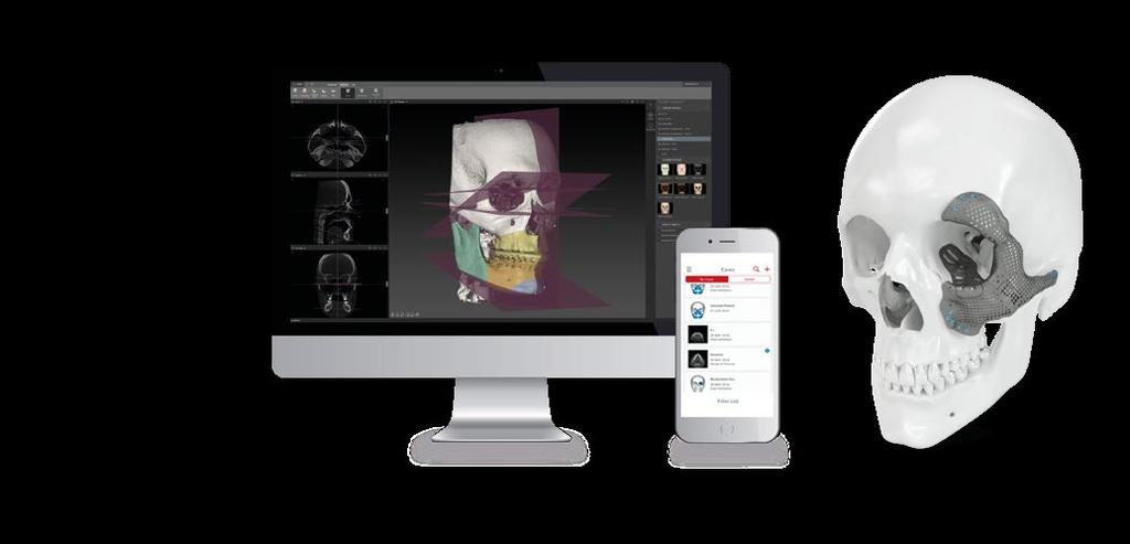 The IPS Product Range IPS CaseDesigner IPS Gate IPS Implants The IPS CaseDesigner makes virtual 3D surgical planning easier and faster than ever before.