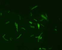 Acid Fast Microscopy (AFB Smear) Rapid & universally available Used to